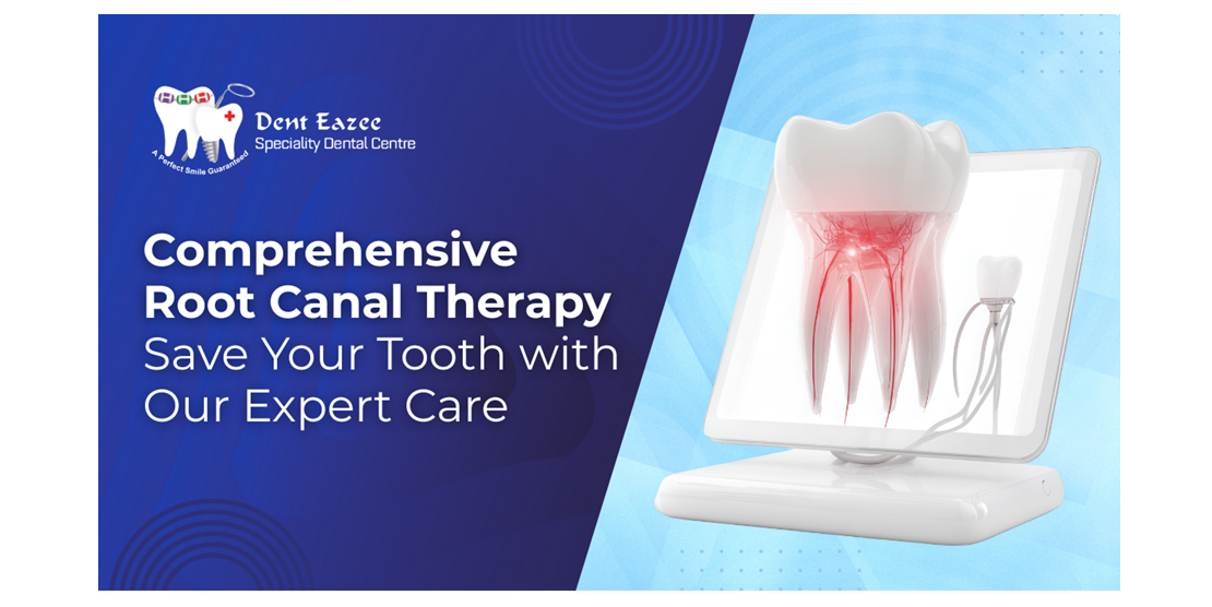 Comprehensive Root Canal Therapy at Dent Eazee Save Your Tooth with Our Expert Care